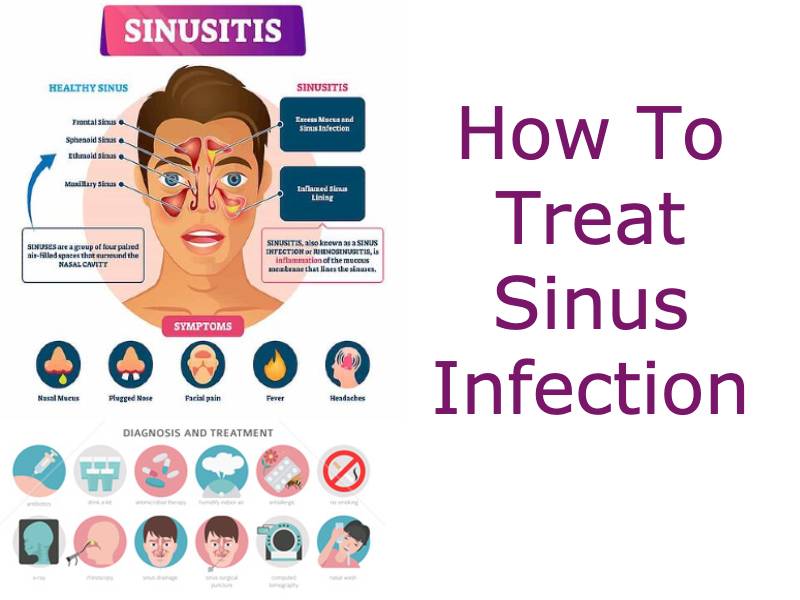 ENT guide on sinus treatment